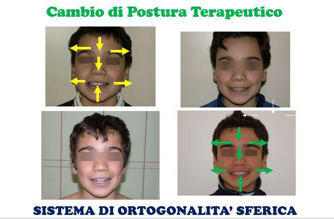 Cambio di postura terapeutico.