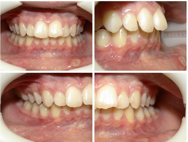 Caso clinico. Arcata dentaria.