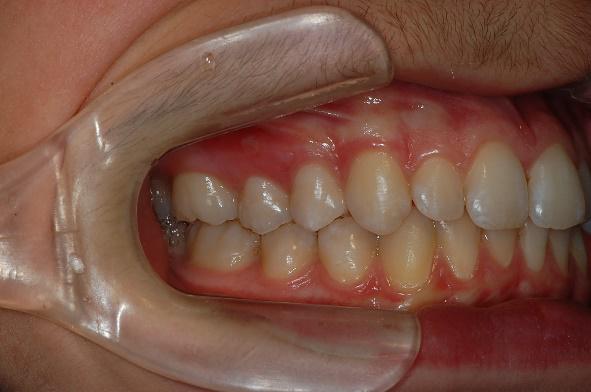 Referto odontoiatrico 2