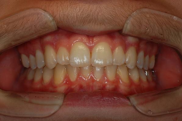 Referto odontoiatrico.