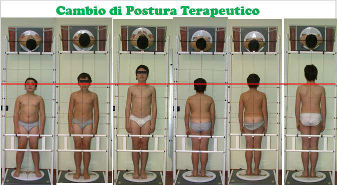 Cambio postura terapeutico