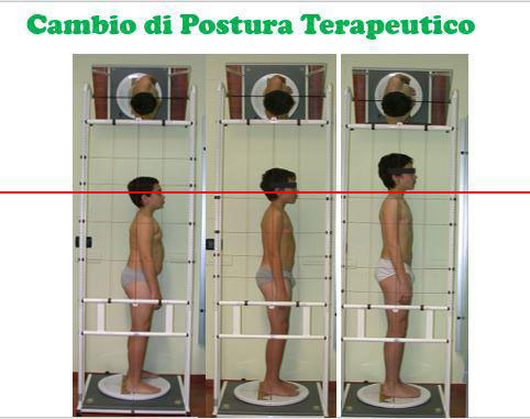 Il cambio postura terapeutico.