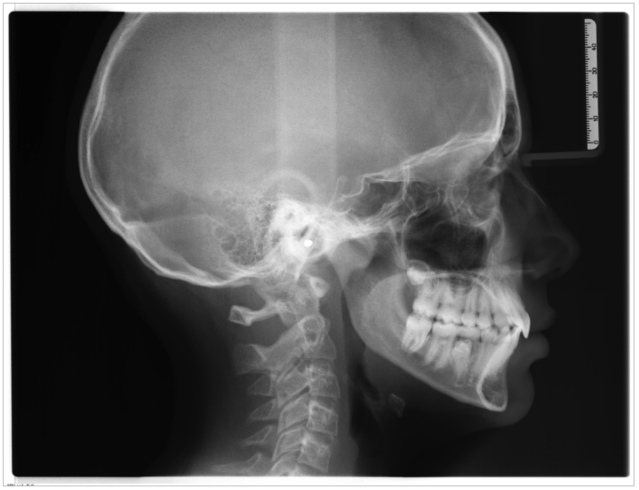 Il cranio e l'arcata dentaria.