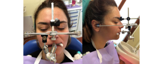 Correlazione tra piano occlusali, arcate dentarie e assetto posturale.