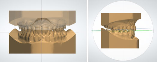 Correlazione tra piano occlusali, arcate dentarie e assetto posturale.