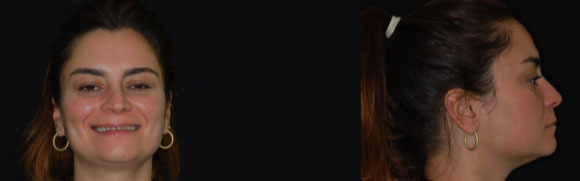 Correlazione tra piano occlusali, arcate dentarie e assetto posturale.