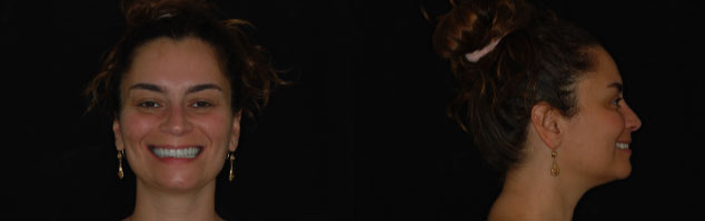 Correlazione tra piano occlusali, arcate dentarie e assetto posturale.