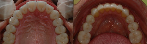 Correlazione tra piano occlusali, arcate dentarie e assetto posturale.