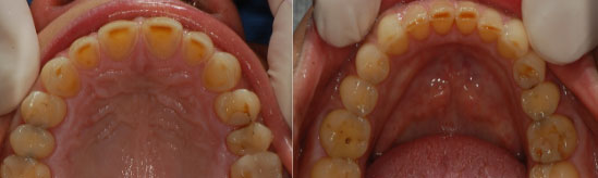 Correlazione tra piano occlusali, arcate dentarie e assetto posturale.